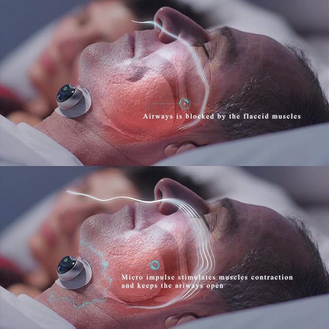 Rechargeable Wearable Muscle-Stimulation Device