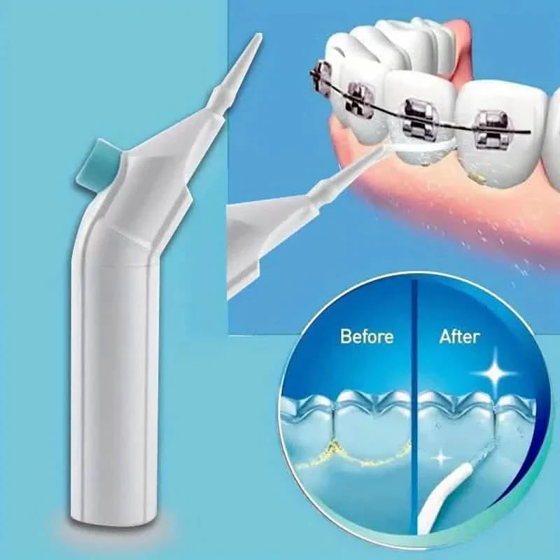 Cordless Water Flosser – Portable Oral Irrigator