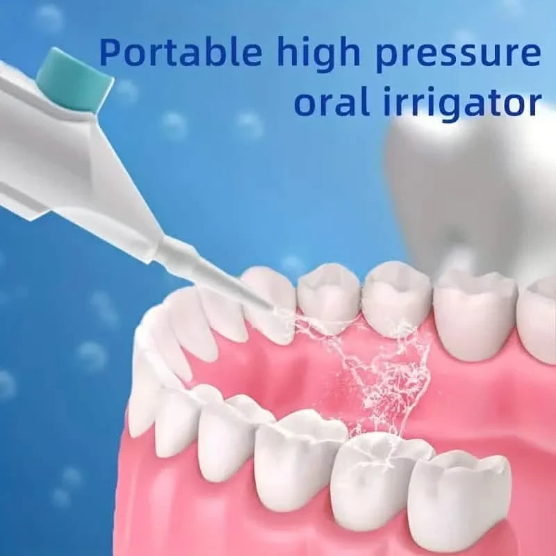 Cordless Water Flosser – Portable Oral Irrigator